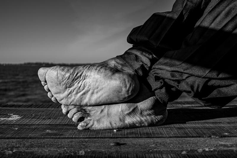 Cracked Heels: The Fix That Isn’t a Pumice Stone